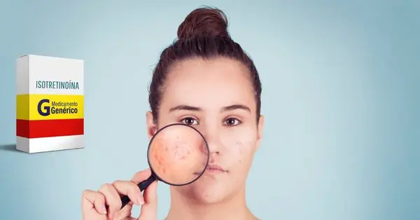 Roacutan ou genérico