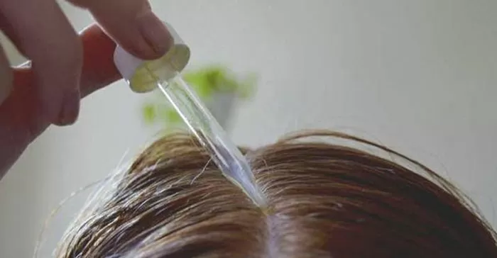 Minoxidil: porque você não deve usar esse produto?