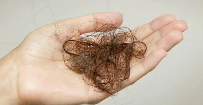 Queda de cabelo: não sofra mais com isso!