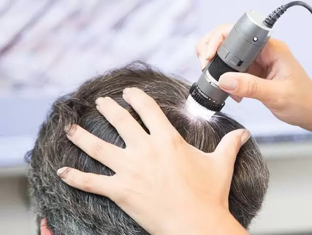 Tricoscopia digital em São Paulo - Clínica Follicles