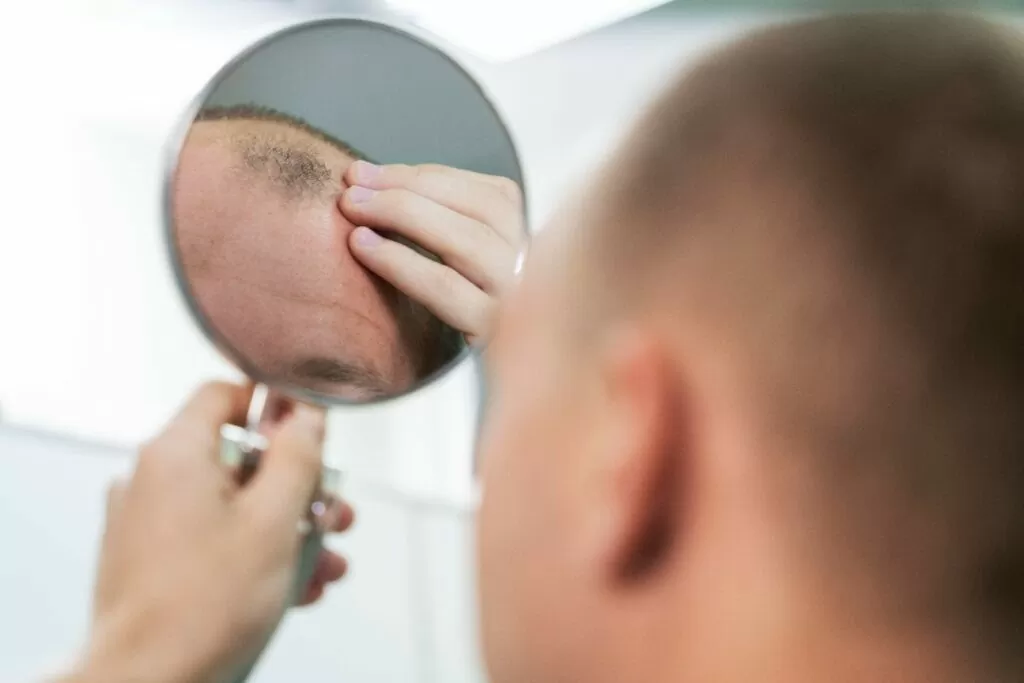 Vitaminas para queda de cabelo